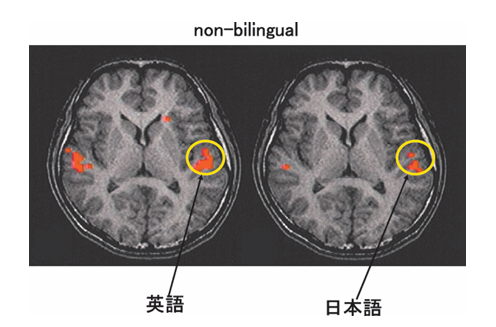 Non-bilingual の fMRI画像