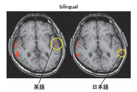 Bilingual の fMRI画像