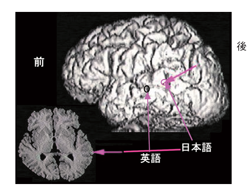 立体再構成図